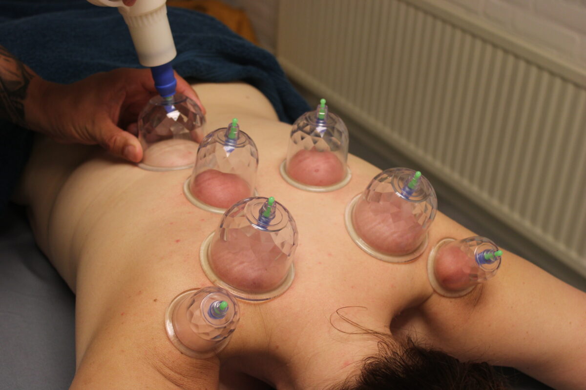 Cupping massage Sneek
