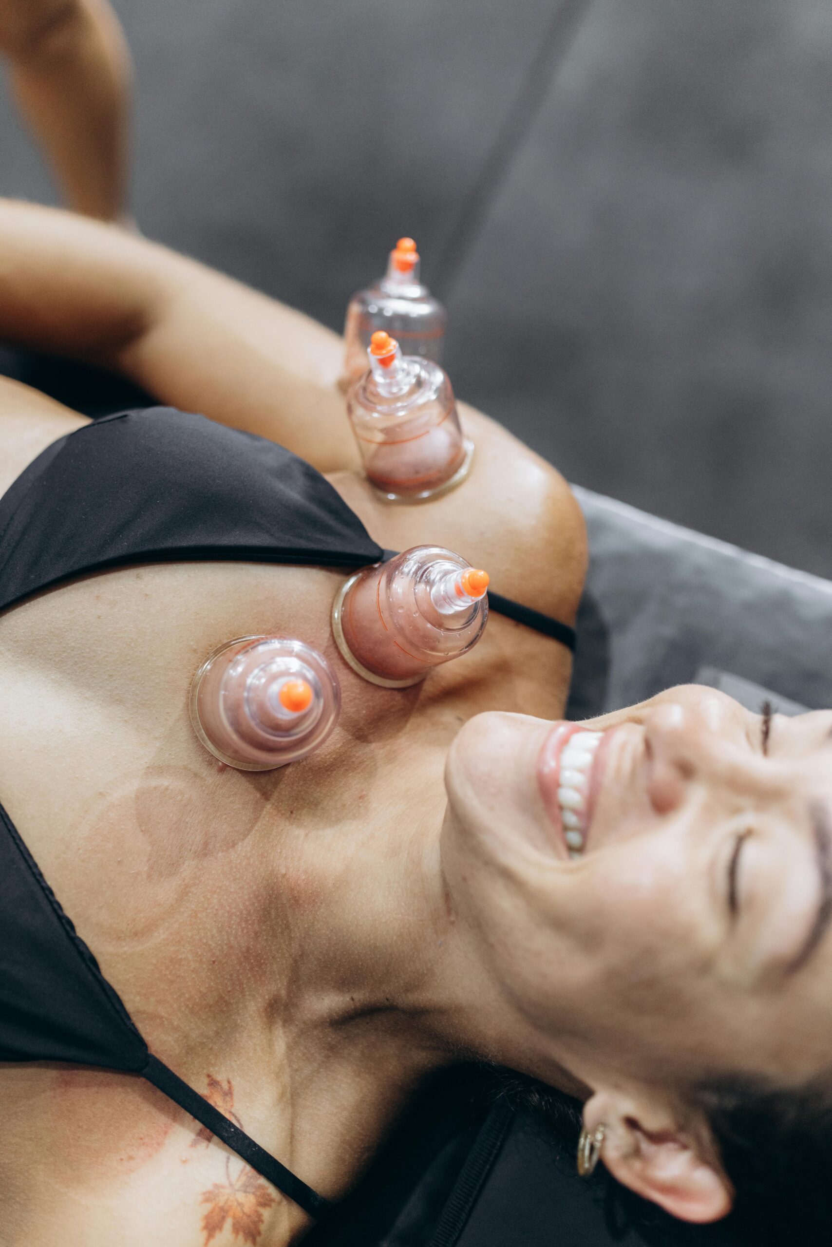 Cupping Massage Infinite Zen - Massage Friesland en Sneek - Cupping massage - anti cellulite cupping
