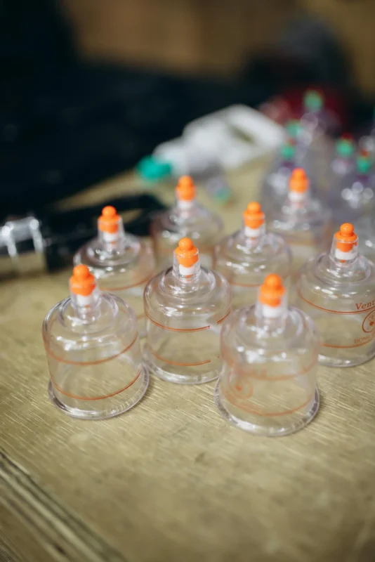 Cupping Massage Cupping massage Sneek met glazen cups